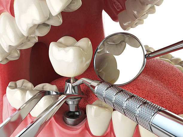 Tooth Infection Emergency Dentist in NE